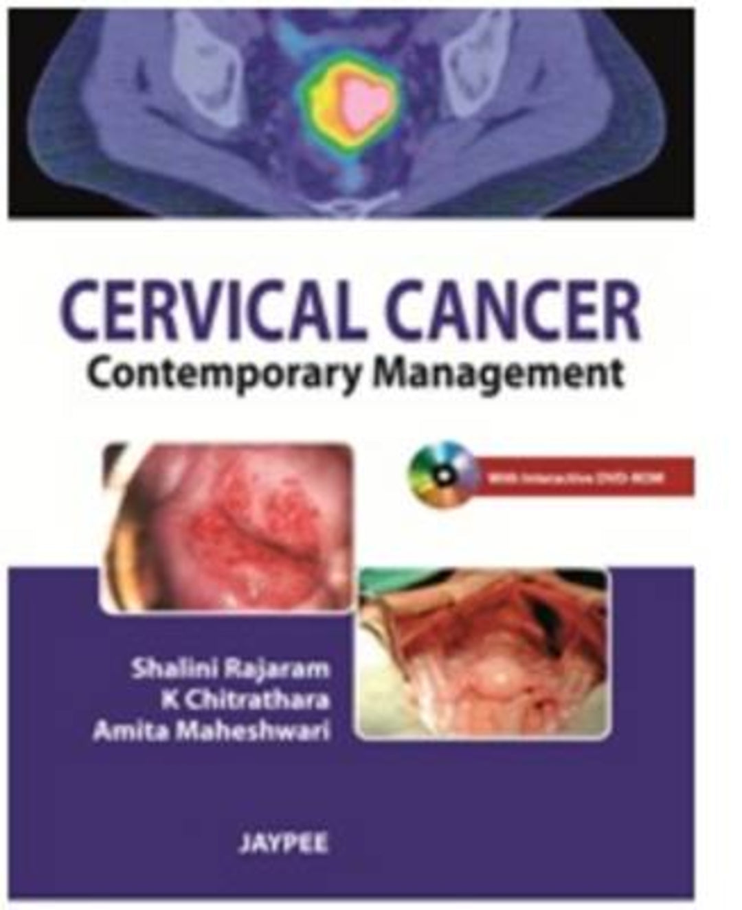 Cover image for Cervical Cancer ISBN 9789350255827